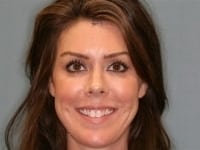 Konig Center for Cosmetic & Comprehensive Dentistry smile photos